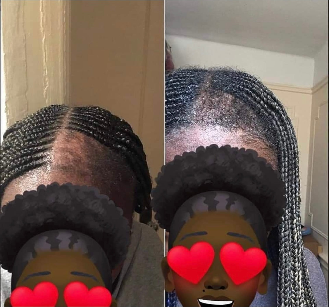 Manifest Hair Growth Serum