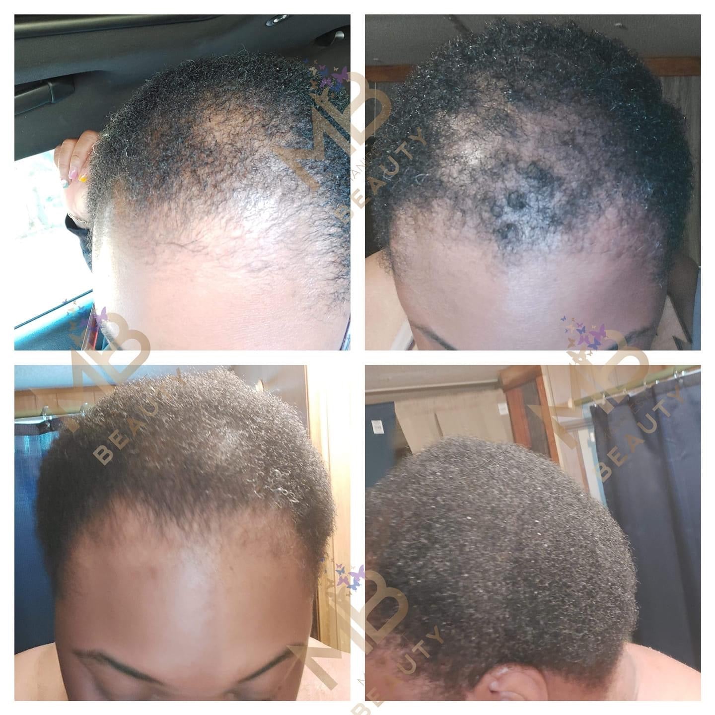 Manifest Growth Shampoo