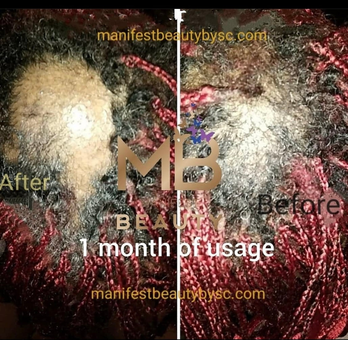 Manifest Hair Growth Serum