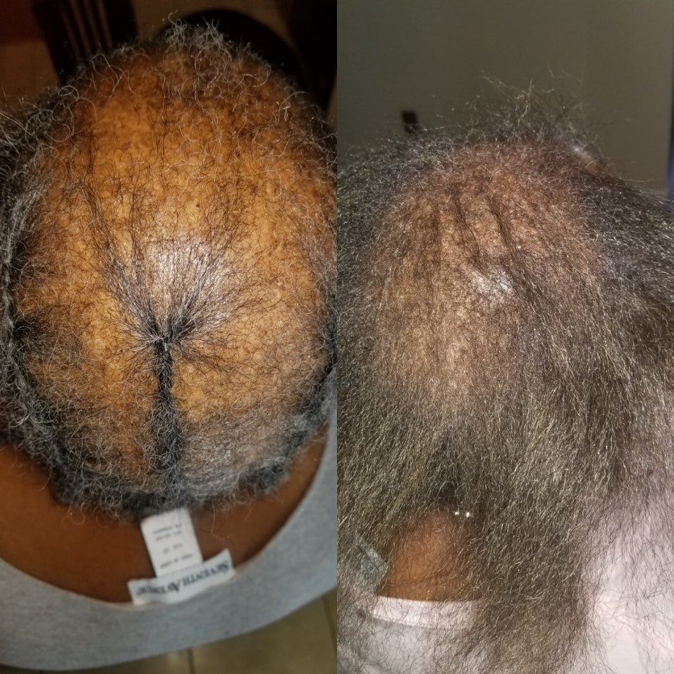 Manifest Hair Growth Serum